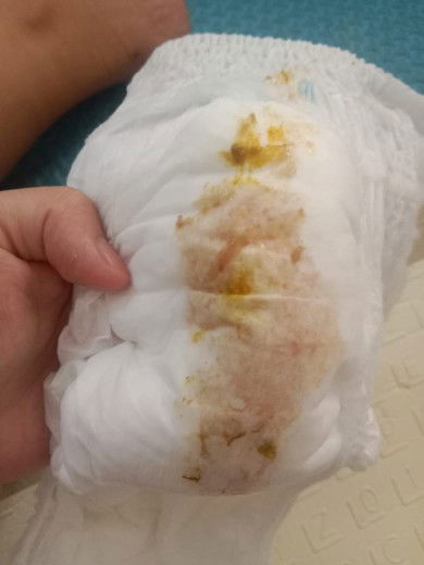 Bun mau tanya anak saya usia 7 bulan bab  keluar lendir sudah 4 hari ini