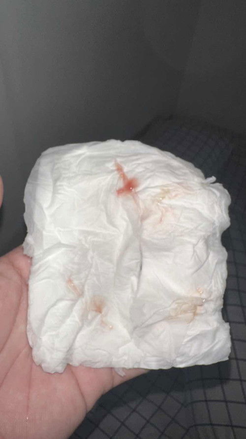 Lendir darah uk 39week tapi mules gk intens