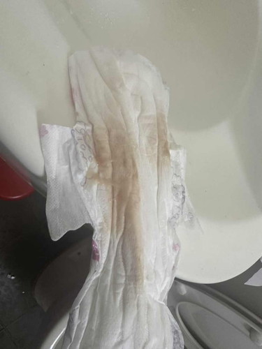 Water breaking ke ni? Air ketuban
