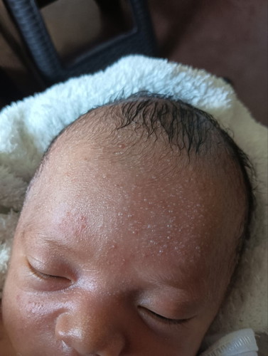 Mga mi normal po ba ito?wala naman po ito paglabas ni baby.