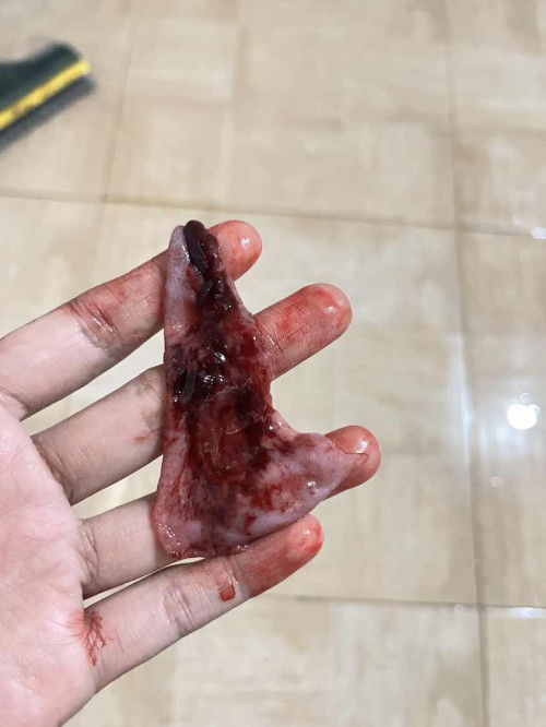 หลังคลอดฉีดยาคุมเป็นประจำเดือน