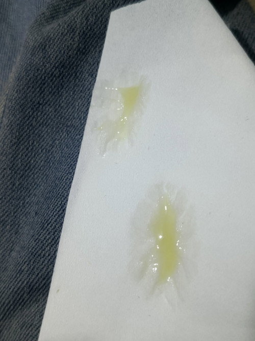 Apakah ini mucus plug?