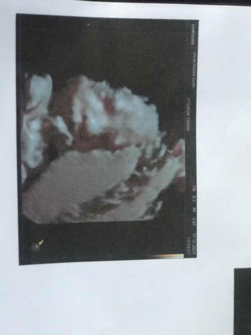 ถามหน่อยค่ะแม่ๆ