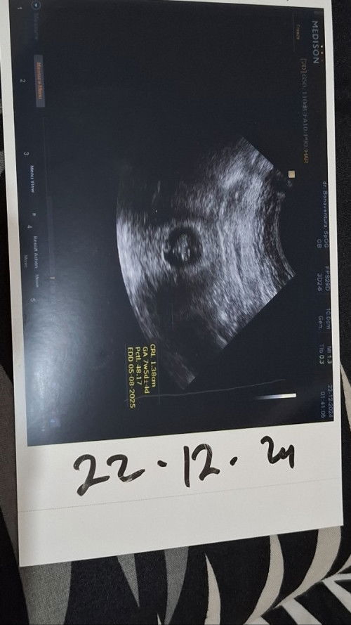 USG 7w 5d berbentuk gumpalan