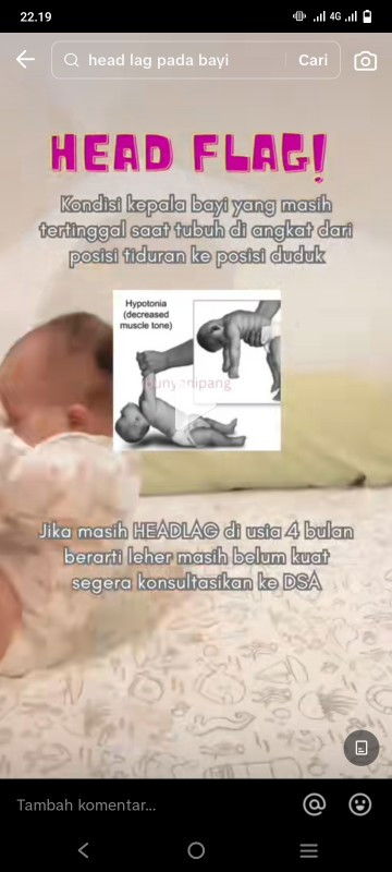 Head lag bayi 4 bulan