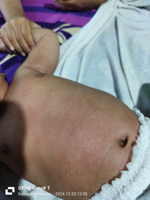 Bagi pengalaman biang keringat atau alergi?