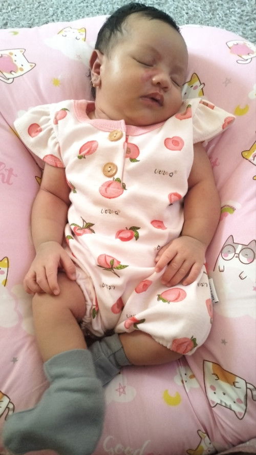 Seperti tanda Merah sejak lahir