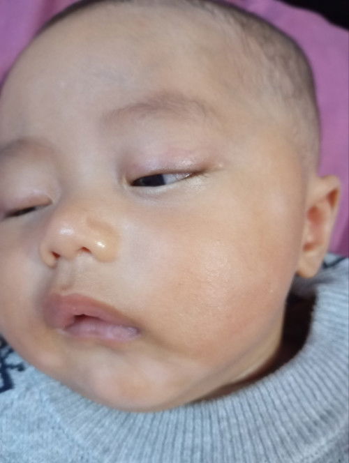 Kulit bayi blang