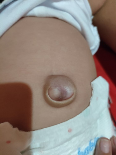 Pusod ni baby