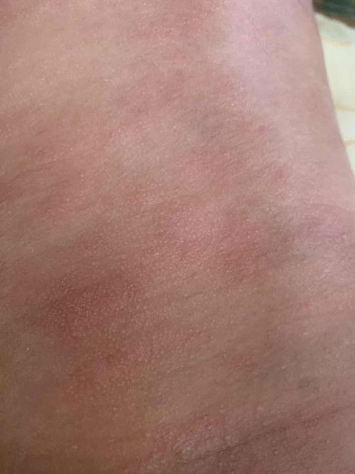 หลังน้องเป็นแบบนี้เกิดจากอะไรคะ