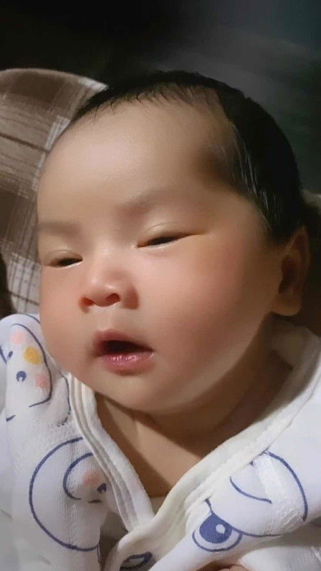 ภาวะตัวเหลืองลูกน้อย เกิดขึ้นได้80%กับทารกแรกเกิด