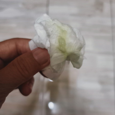 Mukus plug @ keputihan?