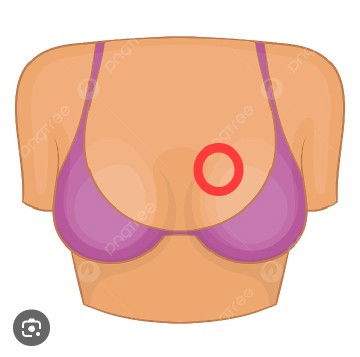 Payudara belah atas sakit