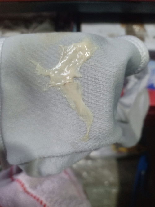 9 Months Pregnant Discharge 
EDD Jan 07, 2025