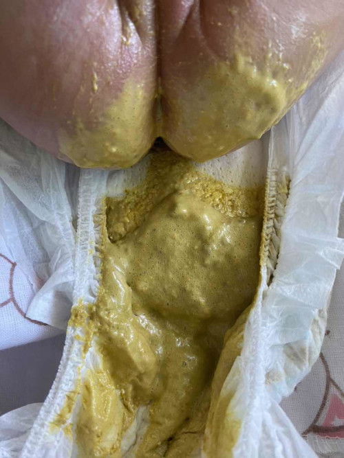 น้องทานนมผงล้วน