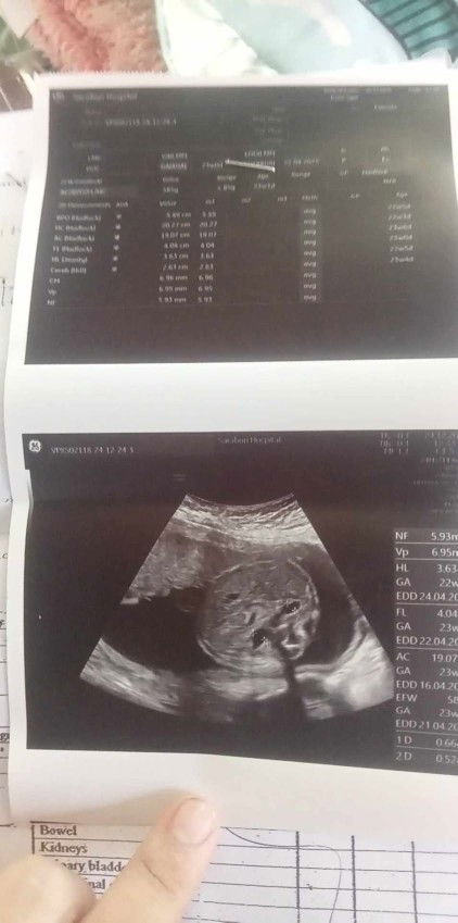 แม่ดูให้หน่อยค่ะคือส่วนไหนของน้องหรอค่ะ