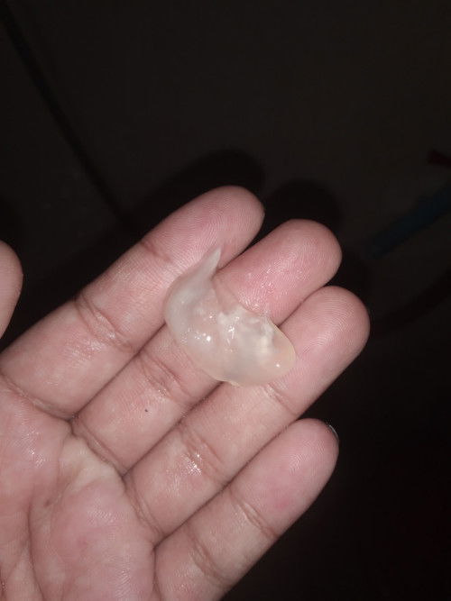 39+1 กำหนดคลอด30ธันวา
แบบนี้คืออ่ะไรคะ