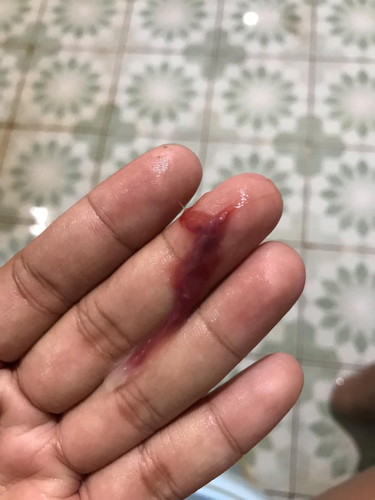 38วีค+4 ควรไปหาหมอเลยไหมคะ