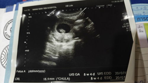 สอบถามหน่อยค่ะ