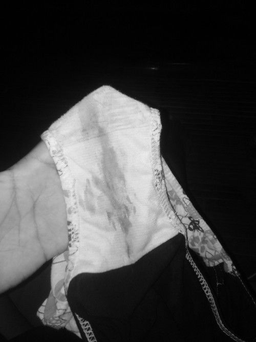 Light brown discharge at 25 weeks and 5 days is it normal?