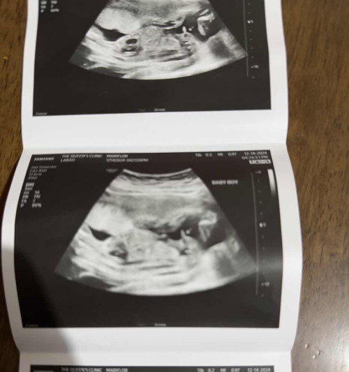 Baby boy  ultra sound