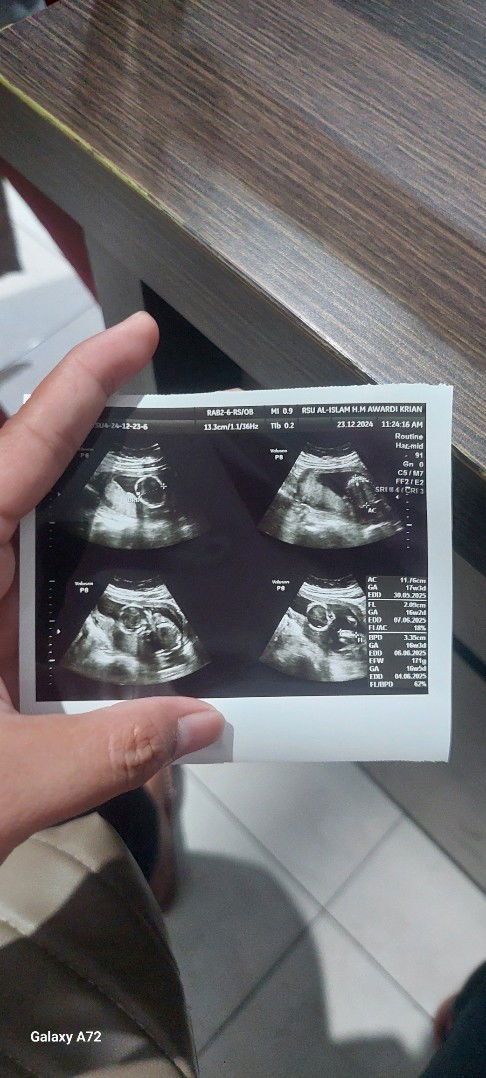 Obat untuk 16 weeks apa aja ya ?