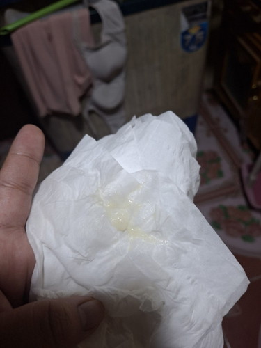 แบบนี้ปกติมั้ยค่ะ
