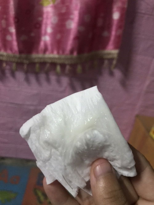 สอบถามแม่ๆทีคะตอนนี้ได้36+6 แบบนี้เรียกมูกหรือตกขาวคะ