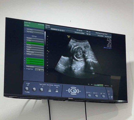 21W น้องเอาหัวลงต่ำ เสี่ยงคลอดก่อนกำหนด ต้องเหน็บยากันแท้ง