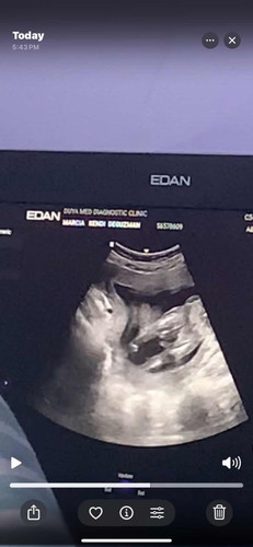 Hello mga mommies, ask lang po if ano pong gender ni baby since un sure pa if girl or boy