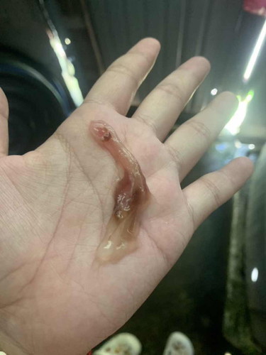 38w+1d มีมูกเลือดเยอะขึ้นต้องไปหาหมอมั้ยค่ะ