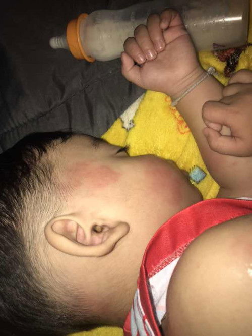 ผื่นคันตามตัวคะ