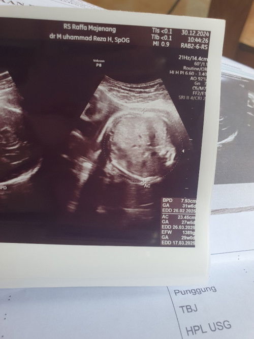 BPD DAN AC SELISIH JAUH