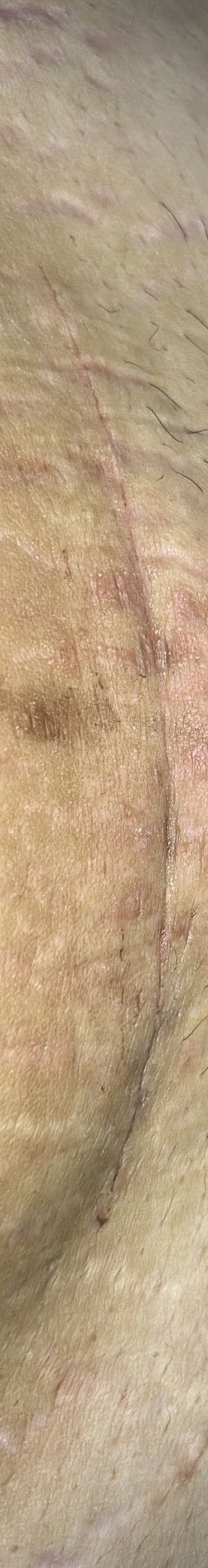 สอบถามแม่ผ่าคลอดหน่อยค่ะ