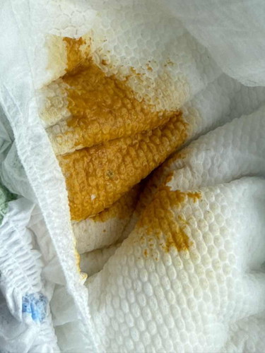 Diarrhea? Help!
