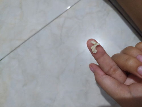 Hamil 9minggu keputihan seperti tepung gtu gk bau gk gatel , normal atau bahaya?