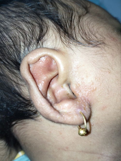 Sharing barangkali ada yang pernah mengalami