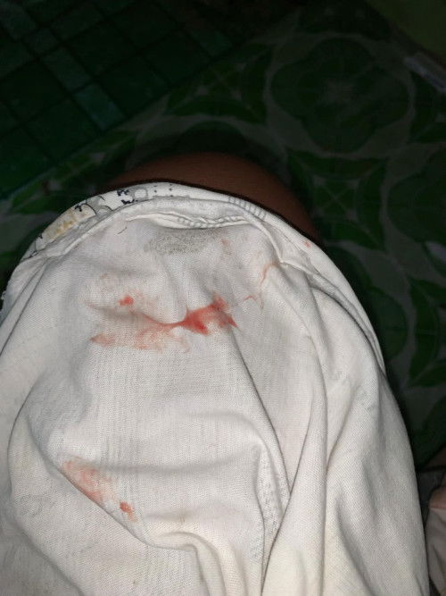 Ask if malapit Naba akong manganak