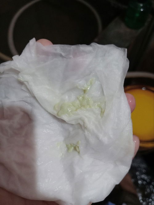 Keputihan saat hamil trimester 2