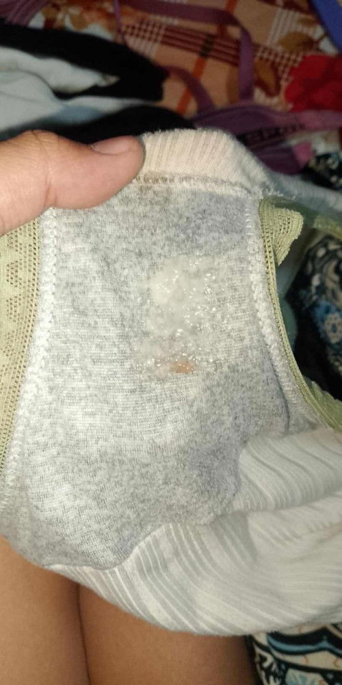 แบบนี้มีมูกเลือดด้วยไหมคะพร้อมคลอดรึป่าวคะ  เมือคืนเจ็บท้องเตือน พอเช้ามามีมูกแต่ไม่มีเลือด ตอนนี้16:37 ออกมาตามภาพเลยคะ