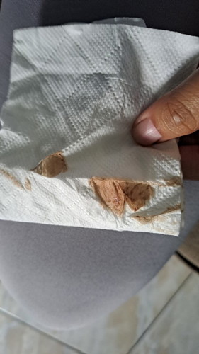 Flek hamil 9 minggu gini bahaya gak ya bun?? Udah minum microgest juga, mau ke dokter untuk usg tapi