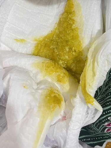 bayi 4 bulan berak kuning kehijauan