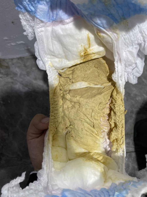 น้องถ่ายสีนี้ปกติมั้ยคะ