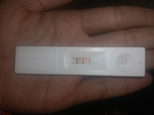 หลังจากที่คลอดเเล้วเสียน้องคนที่สองไป น้องกลับมาแล้ว