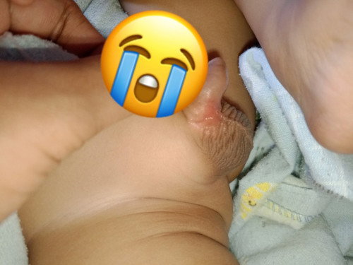 Lecet diarea sensitif