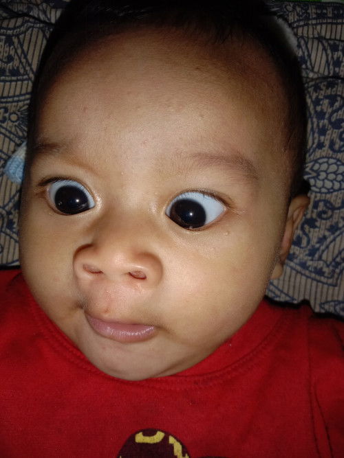 แม่ๆบ้านไหนมีน้องขึ้นเม็ดแบบนี้บ้างค่ะ อยากทราบว่าน้องขึ้นเม็ดอะไรหรือแพ้อะไรบ้างค่ะ