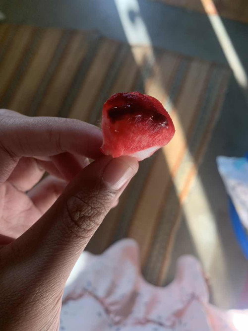 มีหลังคลอด คลอดมาได้20วัน น้ำคาวปลาจางไปแล้วอยู่ๆดีมีเลือดออกมา มีลิ่มเลือดออกมาด้วยผิดปกติมั้ยค่ะ