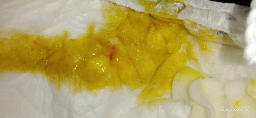 BAB bayi 5 bulan 24 hari