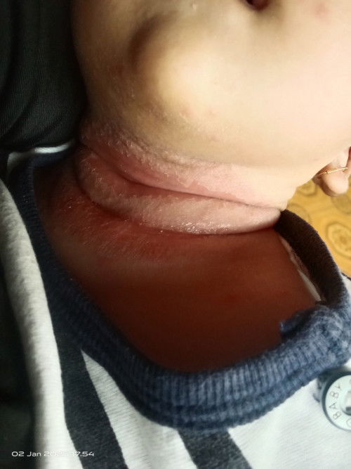 Awalnya sedikit kok lama2 jadi melebar.