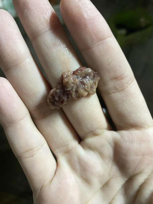 หลังคลอด1เดือนหลังจากตกเลือด